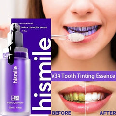 Hismile v34 teeth whither serum