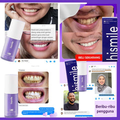 Hismile v34 teeth whither serum